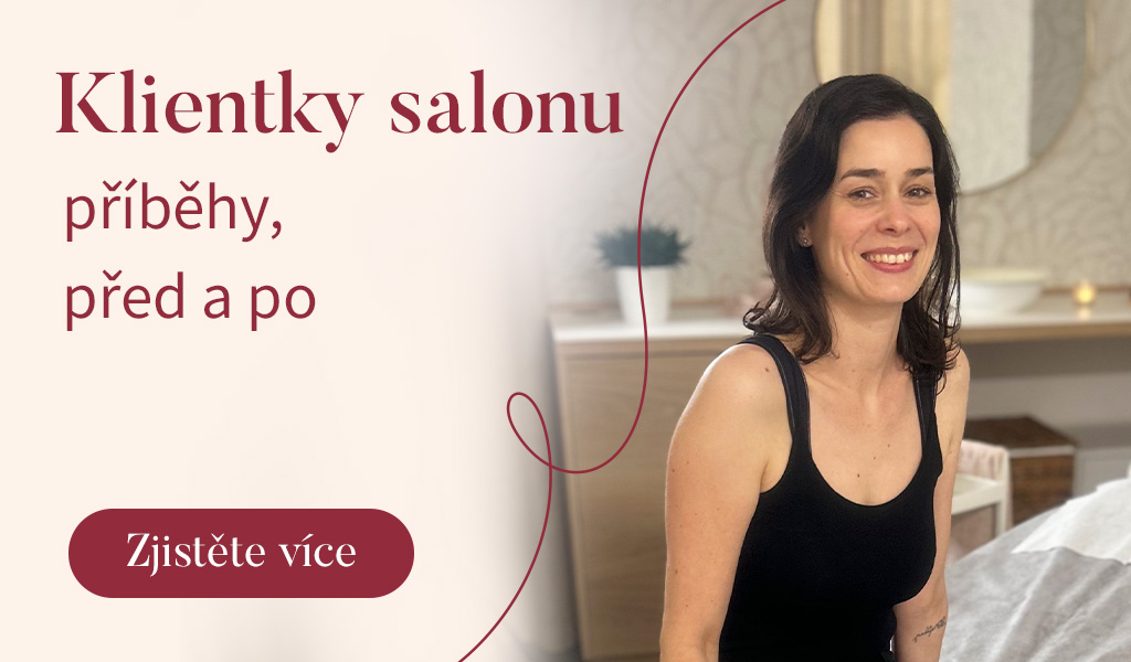 Před a po, proměny, příběhy našich klientek přírodně organického bio salonu kosmetika Hradec Králové