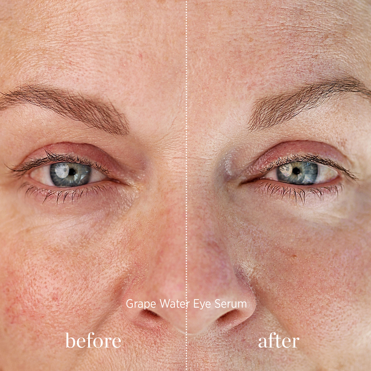 ere_pere_pred_a_po_ocni_serum