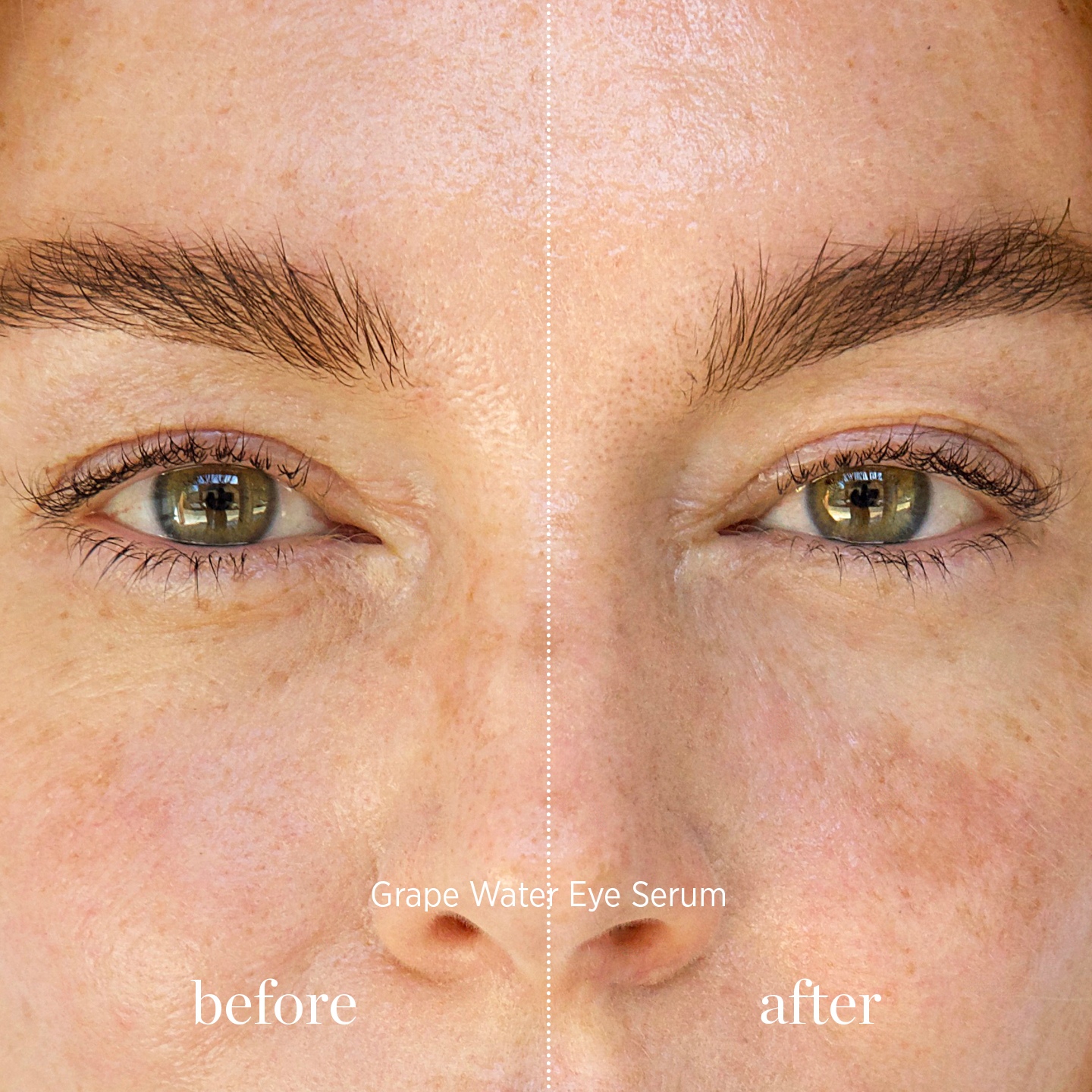 ereperez_pre_a_po_ocni_serum