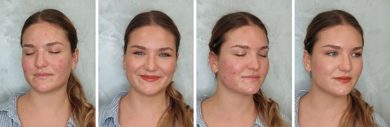 eliska_pred_a_po_kosmeticke_osetreni_salon_liceni