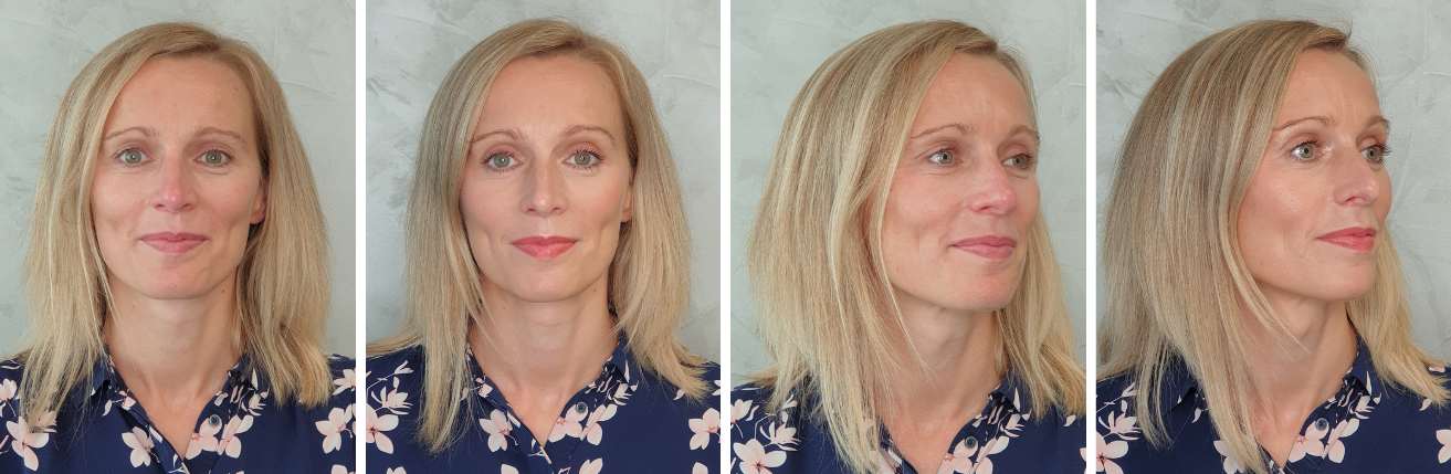 julie_pred_a_po_kosmeticke_osetreni_salon_liceni