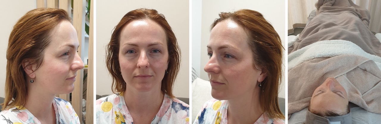 katka_klientka_salonu_skinimalistka