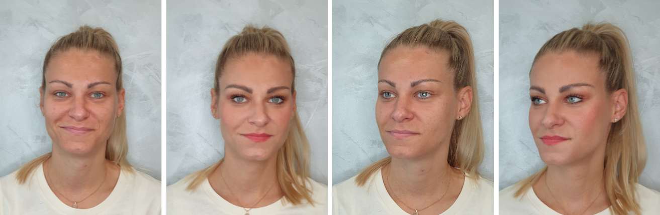 miska_pred_a_po_kosmeticke_osetreni_salon_liceni