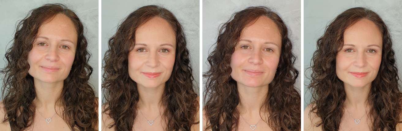 pred_a_po_kosmeticke_osetreni_jana