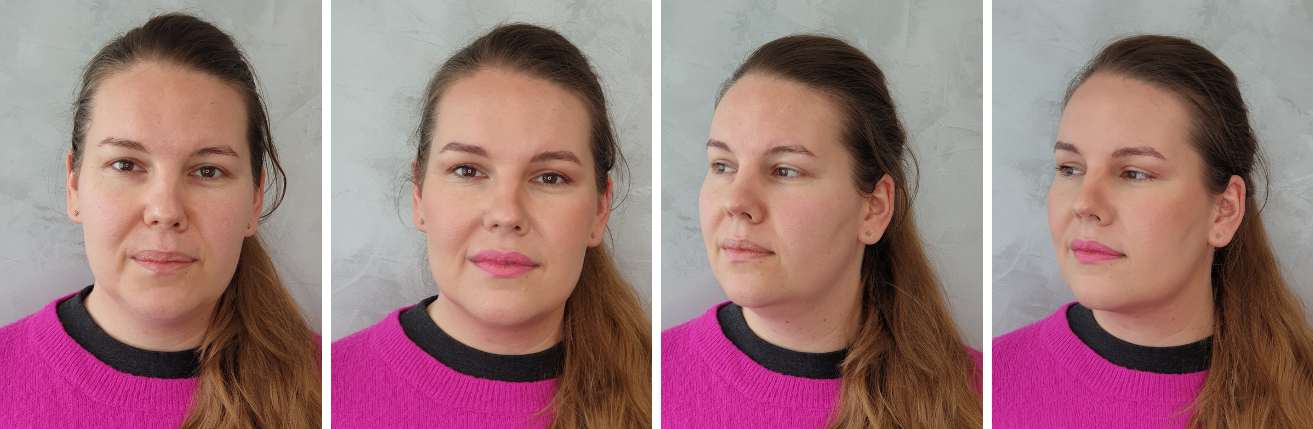 pred_a_po_kosmeticke_osetreni_martina