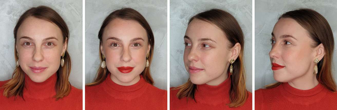 pred_a_po_kosmeticke_osetreni_misa