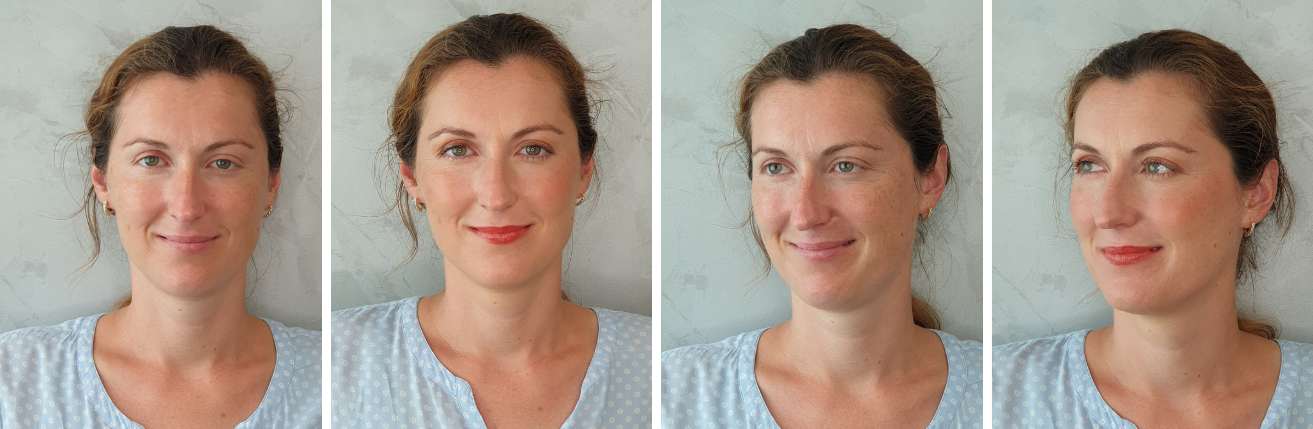 pred_a_po_kosmeticke_osetreni_salon_lenka