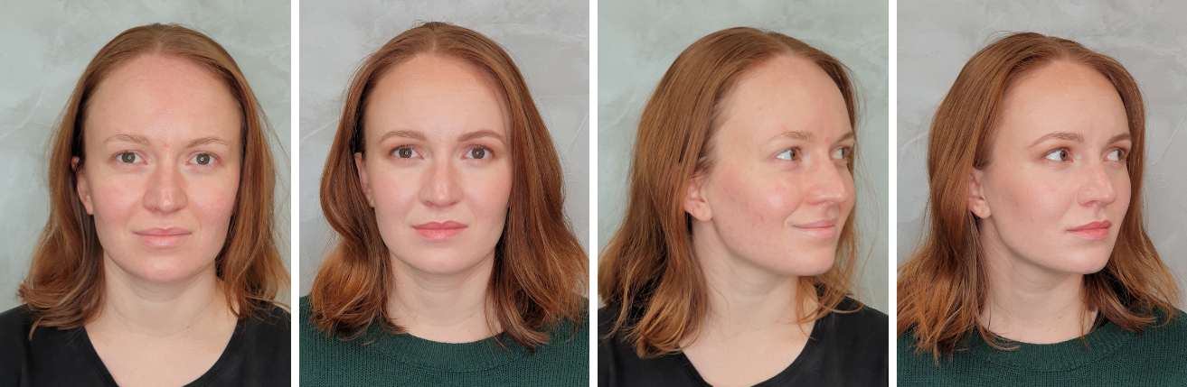 pred_a_po_kosmeticke_osetreni_zuzka